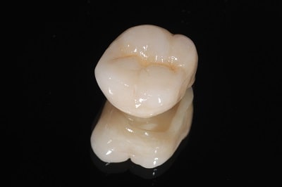 Close up of dental crown