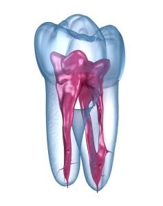 All You Need to Know About Root Canal Therapy