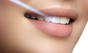 advanced oral health care with laser technology