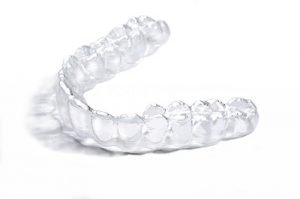 Why Go to a Dentist for Clear Aligners?